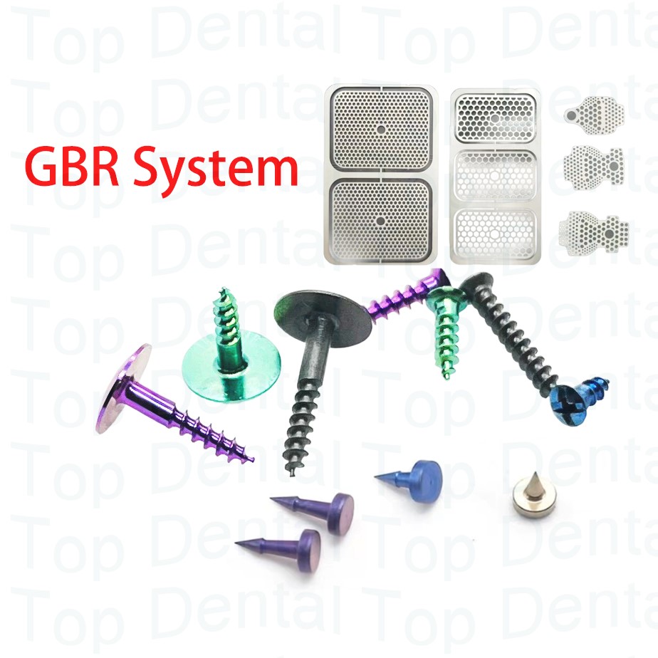 Stabilizer Screw In - 10 pcs Sistem GBR Gigi, Sekrup